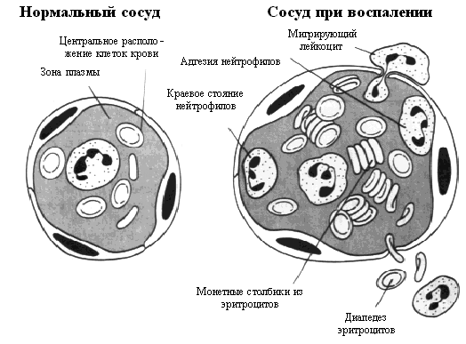 Inflamm2.gif (58184 bytes)