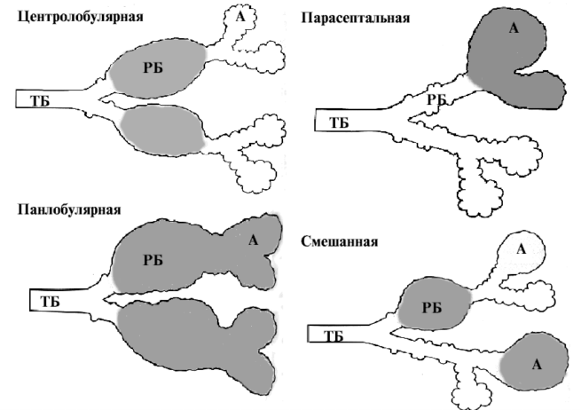 Resp_11.gif (46900 bytes)
